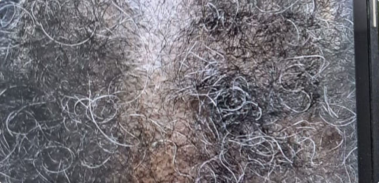 Couro Cabeludo com cabelo cacheado antes do procedimento realizado pela Tricologista Dra. Elaine Macedo